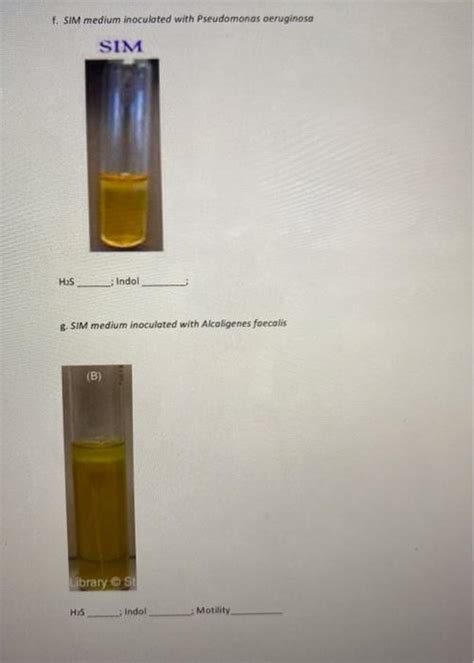 how is sim medium inoculated.